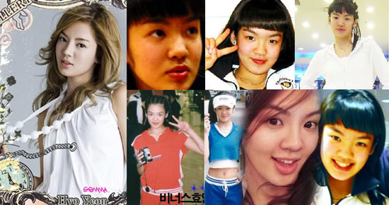 SNSD Hyoyeon before and after
